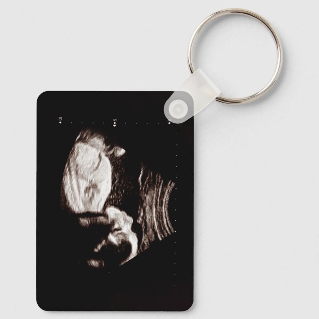 Personalized Baby Ultrasound  Keychain (Back)
