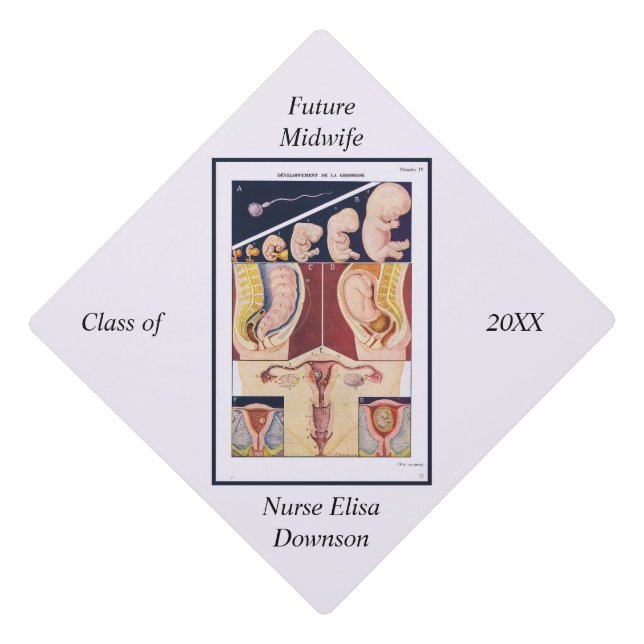 Personalized Future Midwife Retro Graduation  Cap Topper (Front)