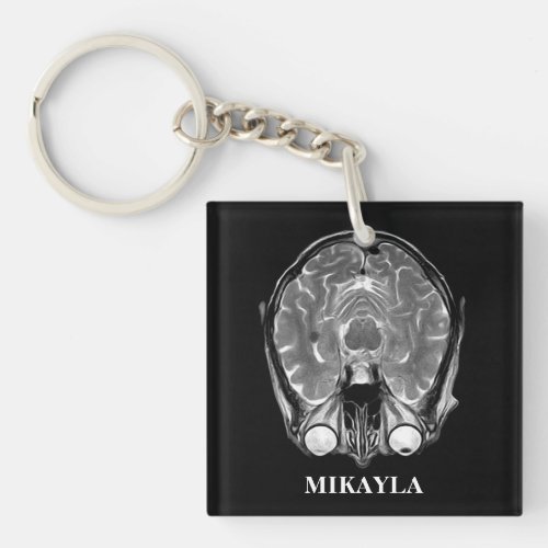 Personalized MRI Brain Scan Keychain