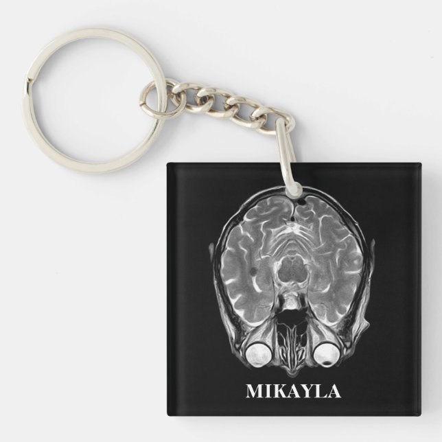 Personalized MRI Brain Scan Keychain (Front)