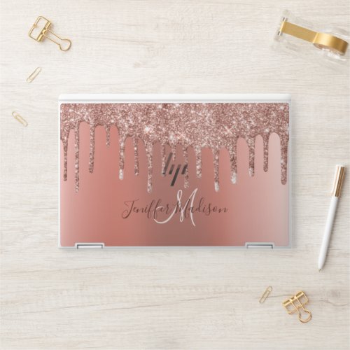 Personalized Rose Gold Glitter Drips Girly Luxury  HP Laptop Skin