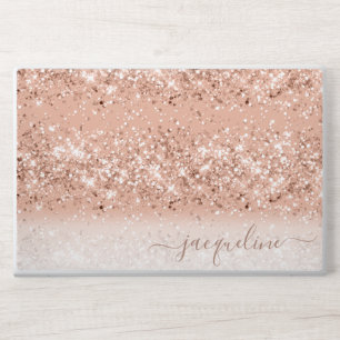 Personalized Rose Gold Glitter HP Laptop Skin