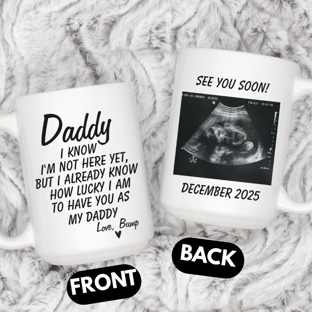 Personalized Sonogram Photo, Ultrasound Photo Baby Coffee Mug (Creator Uploaded)