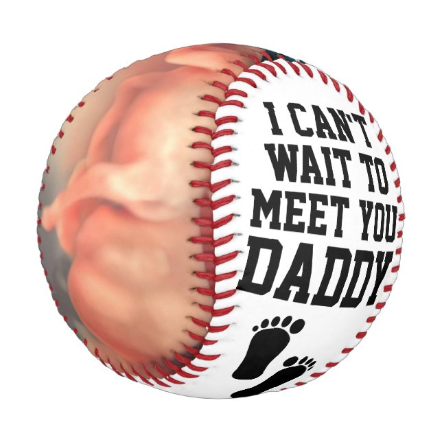 Personalized Sonogram Ultrasound New Daddy Baby Baseball (Angled)
