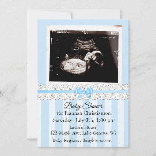 Personalized Ultrasound Baby Shower Invitations Zazzle