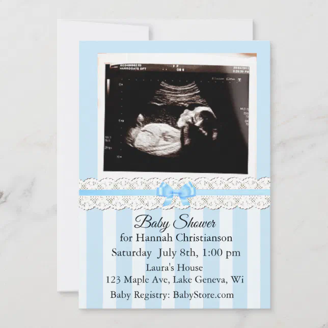 Personalized Ultrasound Baby Shower Invitations | Zazzle