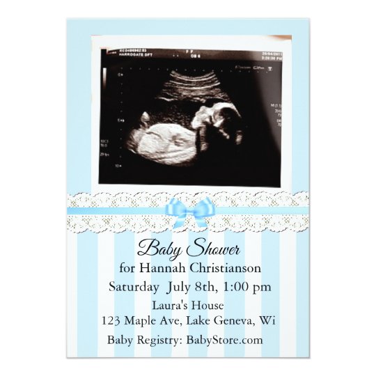 Personalized Ultrasound Baby Shower Invitations | Zazzle.com