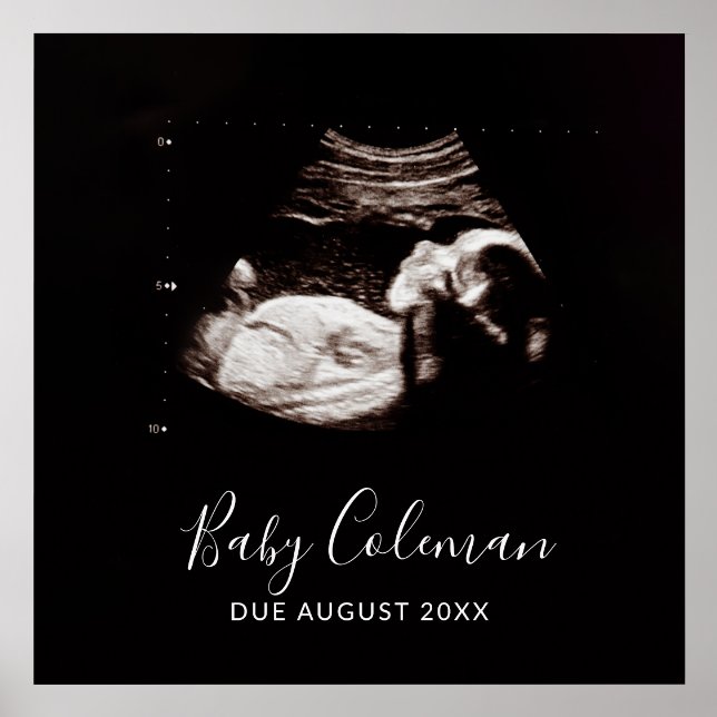  Personalized Ultrasound Keepsake Print Wood Stand (Front)