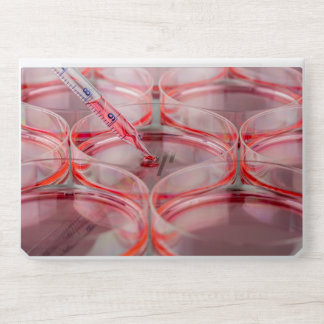 Petri Dishes with Pink Liquid and Thermometer Labo HP Laptop Skin