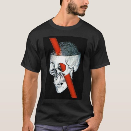 Phineas Gage T_Shirt