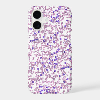 Phone case(many models)-Chronic Lymphomic Leukemia iPhone 17 Case