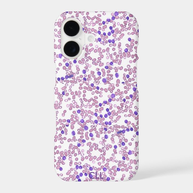 Phone case(many models)-Chronic Lymphomic Leukemia Case-Mate iPhone Case (Back)
