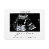 Cute Ideas For Baby Sonogram Pictures – LujaStyles