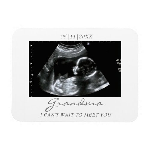 Photo Magnet Ultrasound Gifts for Grandma Sonogram