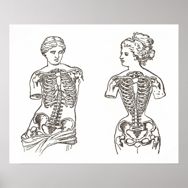 Physical Impact of Wearing Corsets Medical Print (Front)