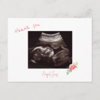  Pink Baby Shower Ultrasound Cute Font Thank You