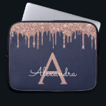 Pink Rose Gold Navy Blue Glitter Sparkle Monogram Laptop Sleeve<br><div class="desc">Pink Rose Gold and Navy Blue Faux Dripping Modern and Elegant Girly Glitter and Sparkle Elegant Monogram Case. This case can be customized to include your initial and first name.</div>