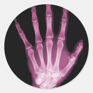 Pink X-ray Skeleton Hand Classic Round Sticker