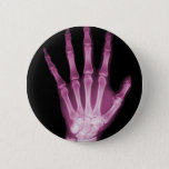 Pink X-ray Skeleton Hand Pinback Button at Zazzle