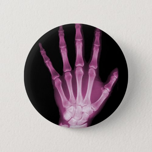 Pink X_ray Skeleton Hand Pinback Button