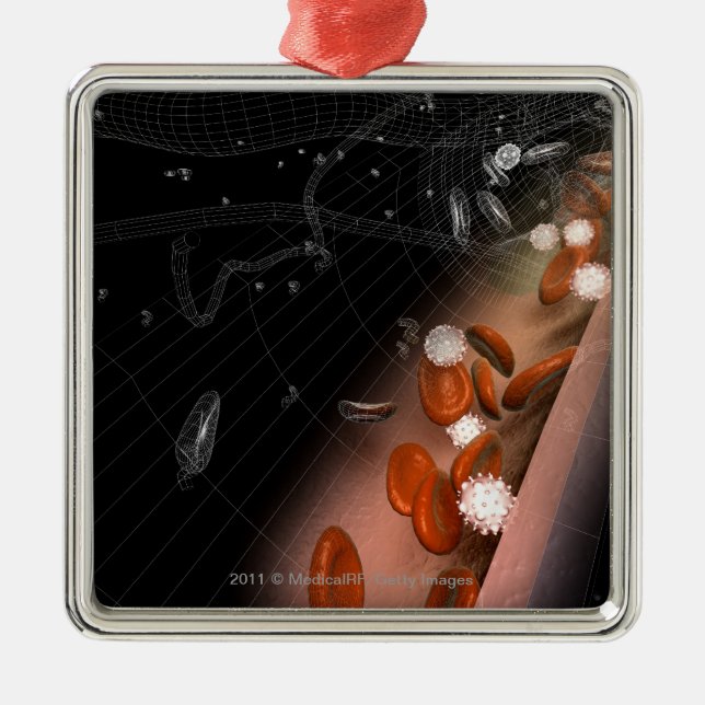 Plaque in the arteries metal ornament (Front)