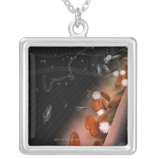 Plaque in the arteries silver plated necklace