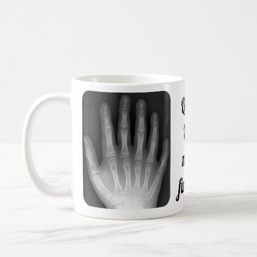 Polydactyl Hand Xray Coffee Mug