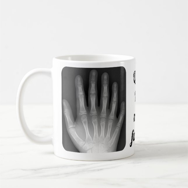 Polydactyl Hand Xray Coffee Mug (Left)