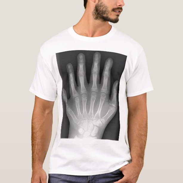 X Ray TShirts X Ray TShirt Designs Zazzle