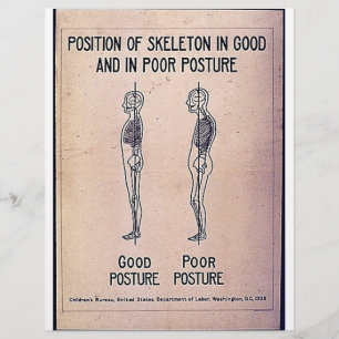Position Of Skeleton In Good And In Poor Posture