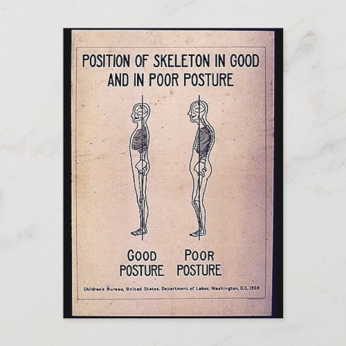 Position Of Skeleton In Good And In Poor Posture Postcard