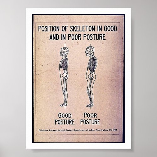 Position Of Skeleton In Good And In Poor Posture Poster