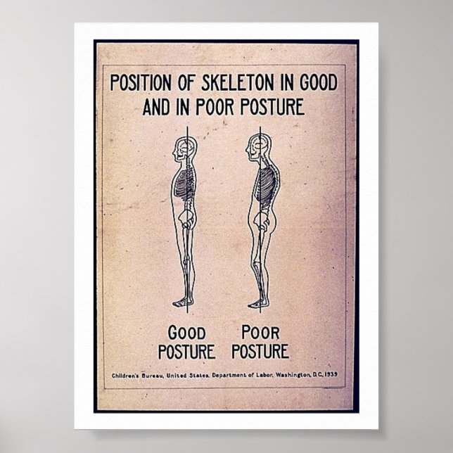 Position Of Skeleton In Good And In Poor Posture Poster (Front)
