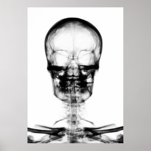 POSTER/PRINT X-RAY VISION SKELETON SKULL - B&W POSTER