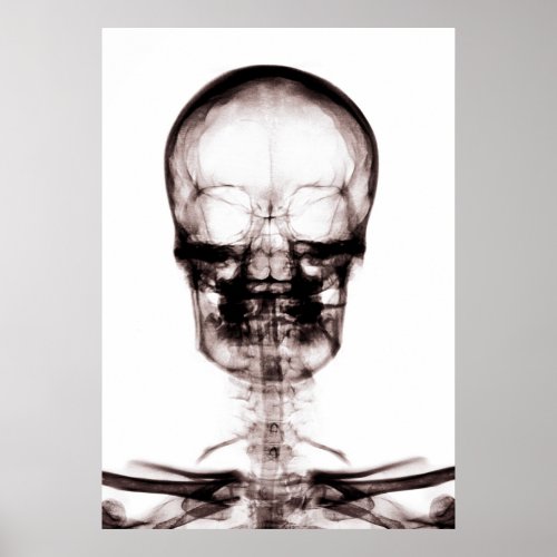 POSTERPRINT X_RAY VISION SKELETON SKULL ORIGNEG POSTER