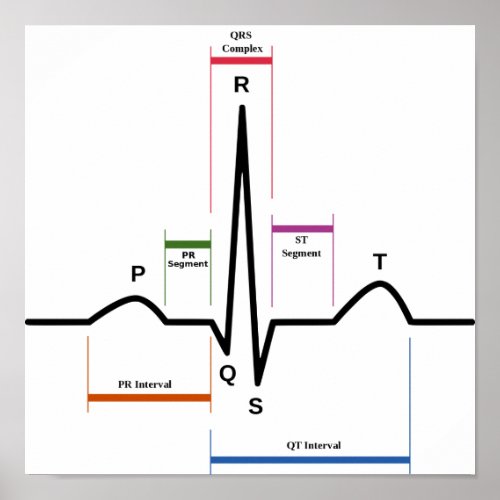 Poster Sinus Rhythm Electrocardiogram ECG Diagram