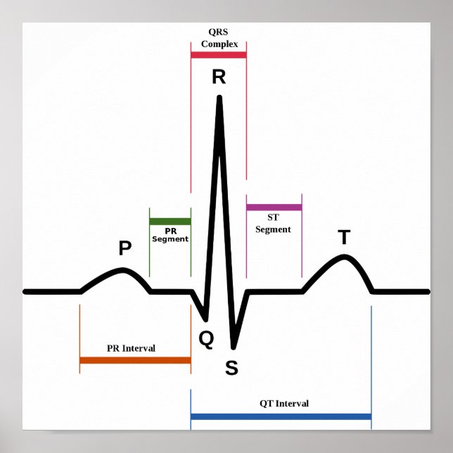Poster Sinus Rhythm Electrocardiogram ECG Diagram (Front)