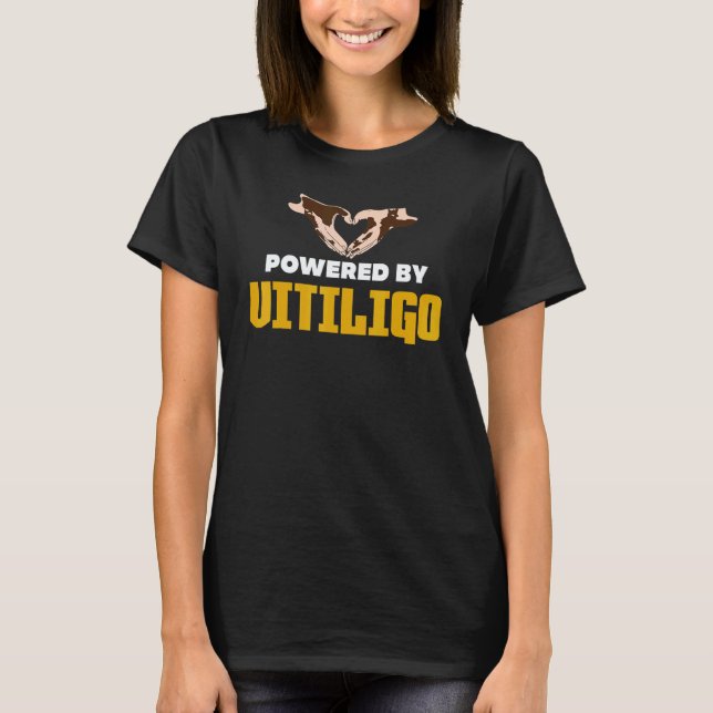 Powered By Vitiligo T-Shirt (Front)