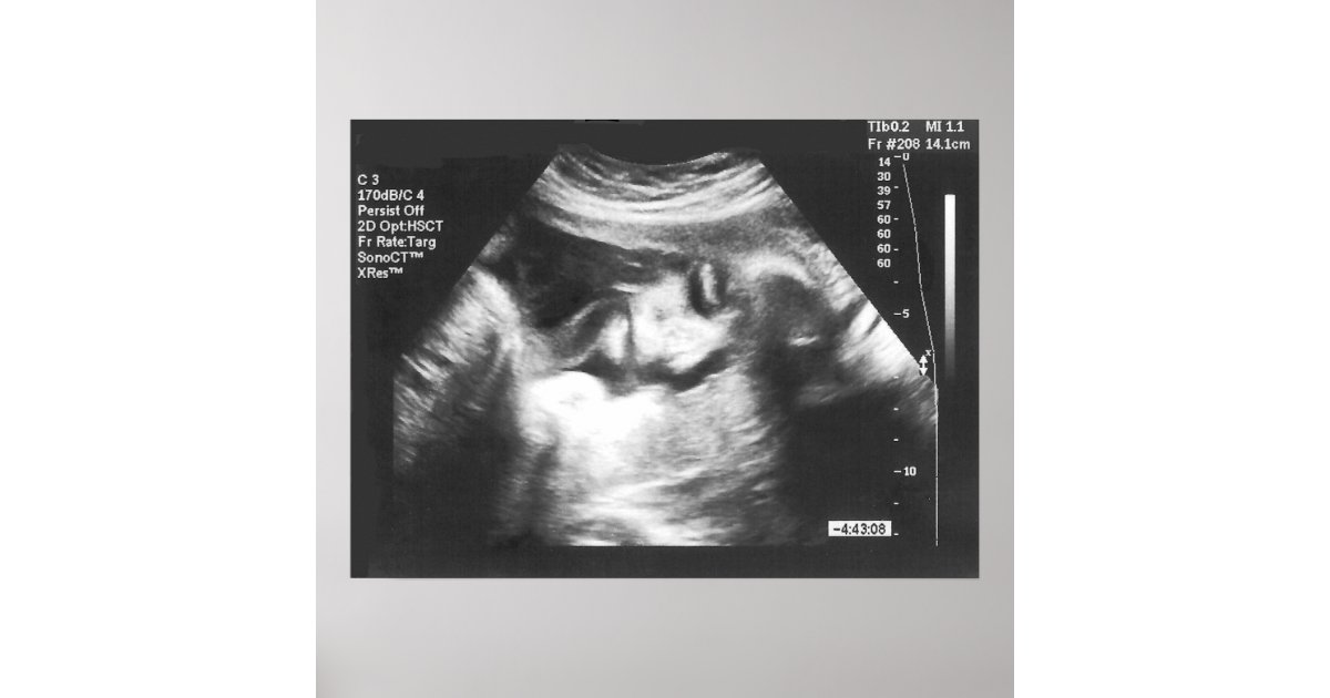 25 Best Photos Free Fake Ultrasound App Iphone / Free Mobile Ultrasound Signal Processing App on iPad ...