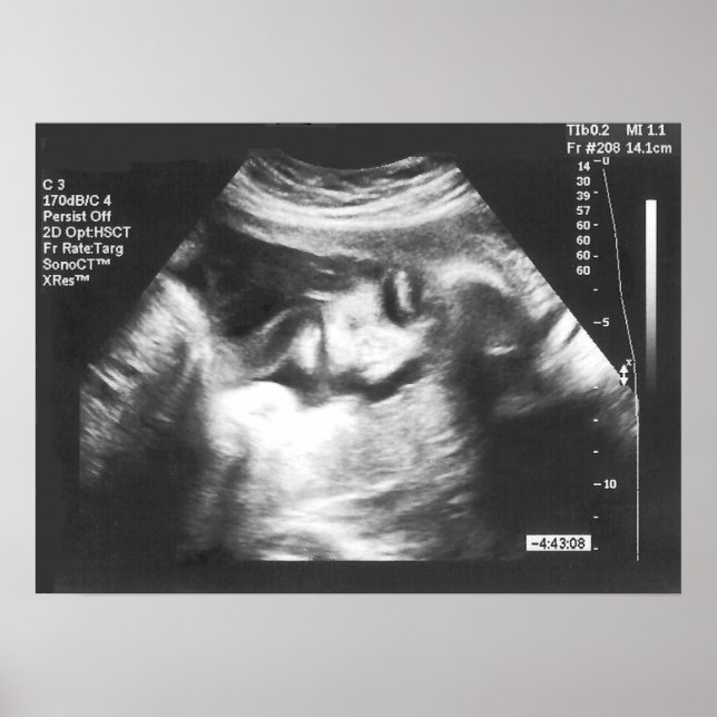 Prank Fake Ultrasound Picture Poster (Front)