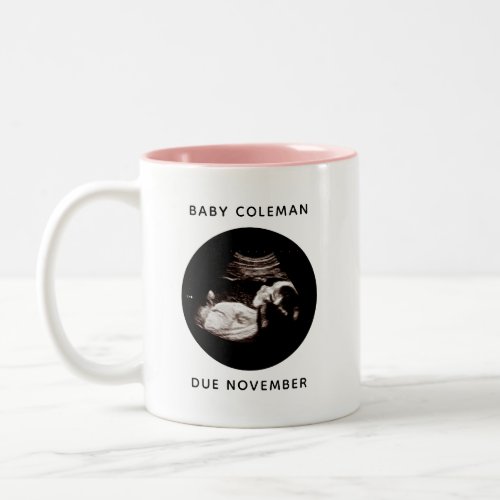 Pregnancy Announcement Baby Girl Sonogram Photo Two_Tone Coffee Mug