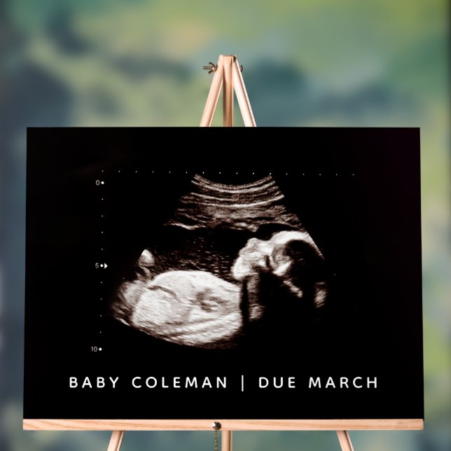 Pregnancy Announcement Baby Shower Sonogram Acrylic Sign (Neutral)