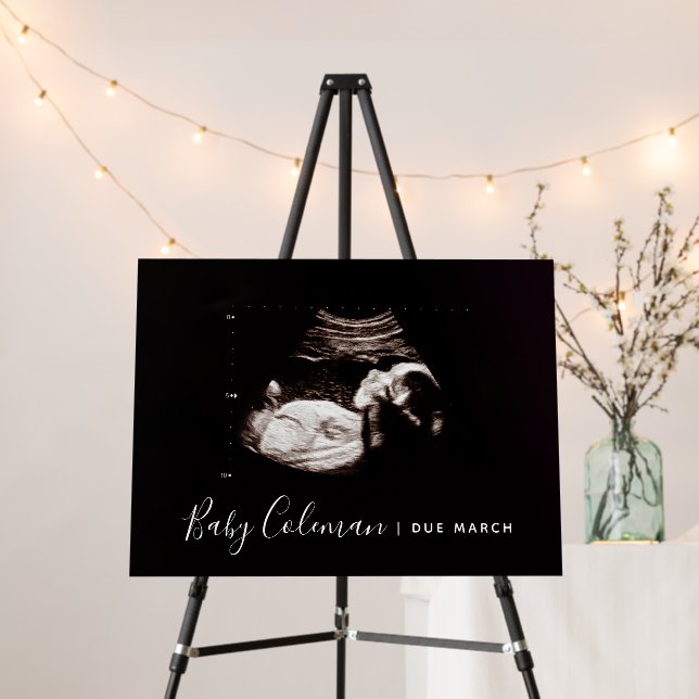 Pregnancy Announcement Baby Shower Sonogram Sign (In Situ (Stand))