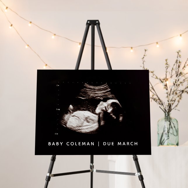 Pregnancy Announcement Baby Shower Sonogram Sign (In Situ (Stand))
