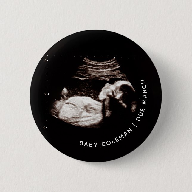 Pregnancy Announcement Baby Sonogram Photo Button (Front)