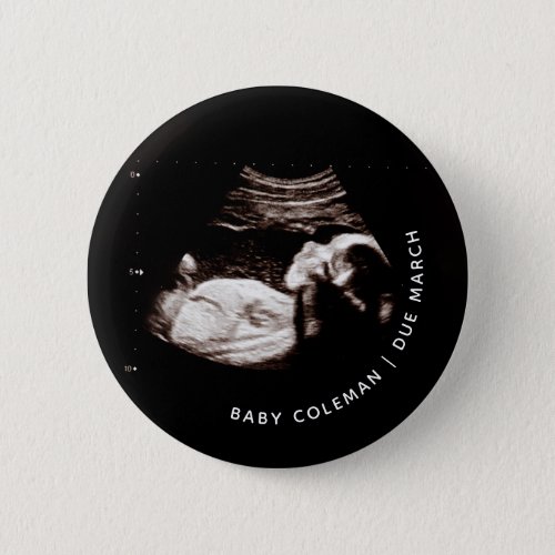 Pregnancy Announcement Baby Sonogram Photo Button