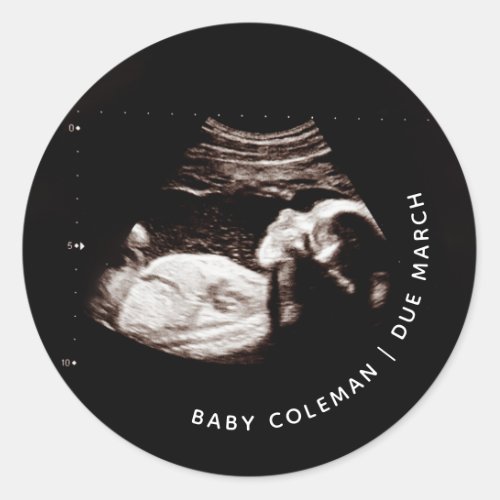 Pregnancy Announcement Baby Sonogram Photo Classic Round Sticker