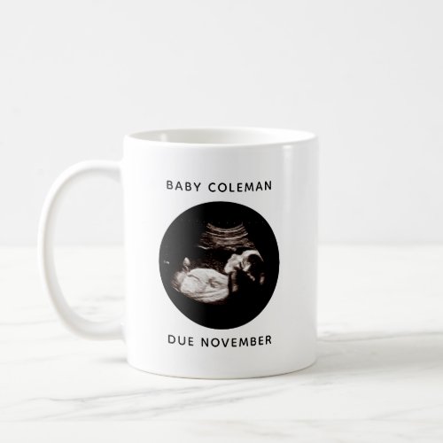 Pregnancy Announcement Baby Sonogram Photo Coffee Mug