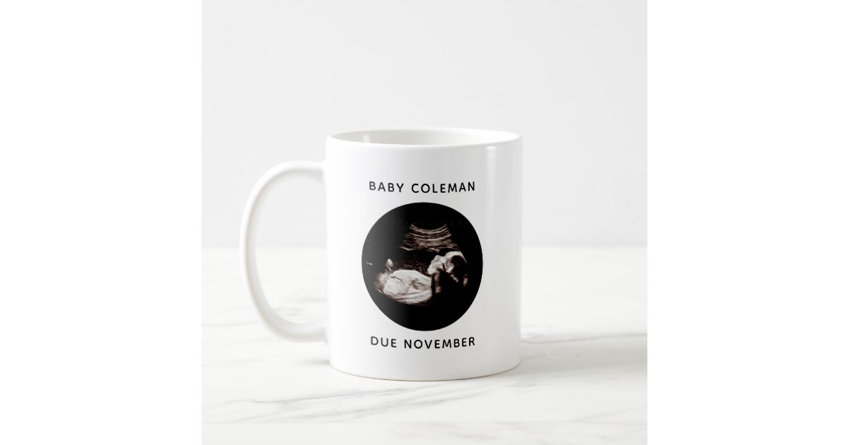 https://rlv.zcache.com/pregnancy_announcement_baby_sonogram_photo_coffee_mug-r7fc194cac47a42a9b63b4a5b7146a3ff_x7jg9_8byvr_630.jpg?view_padding=%5B285%2C0%2C285%2C0%5D