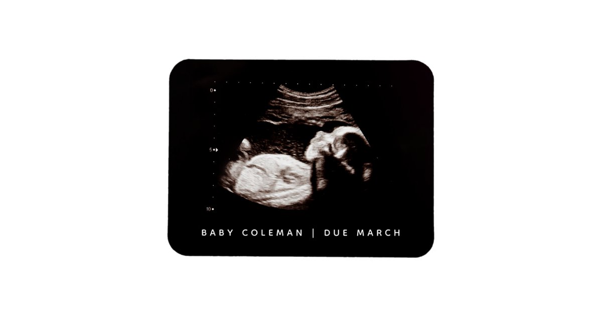 Sonogram Magnets Pregnancy Announcement Baby Sonogram Photo Magnet | Zazzle